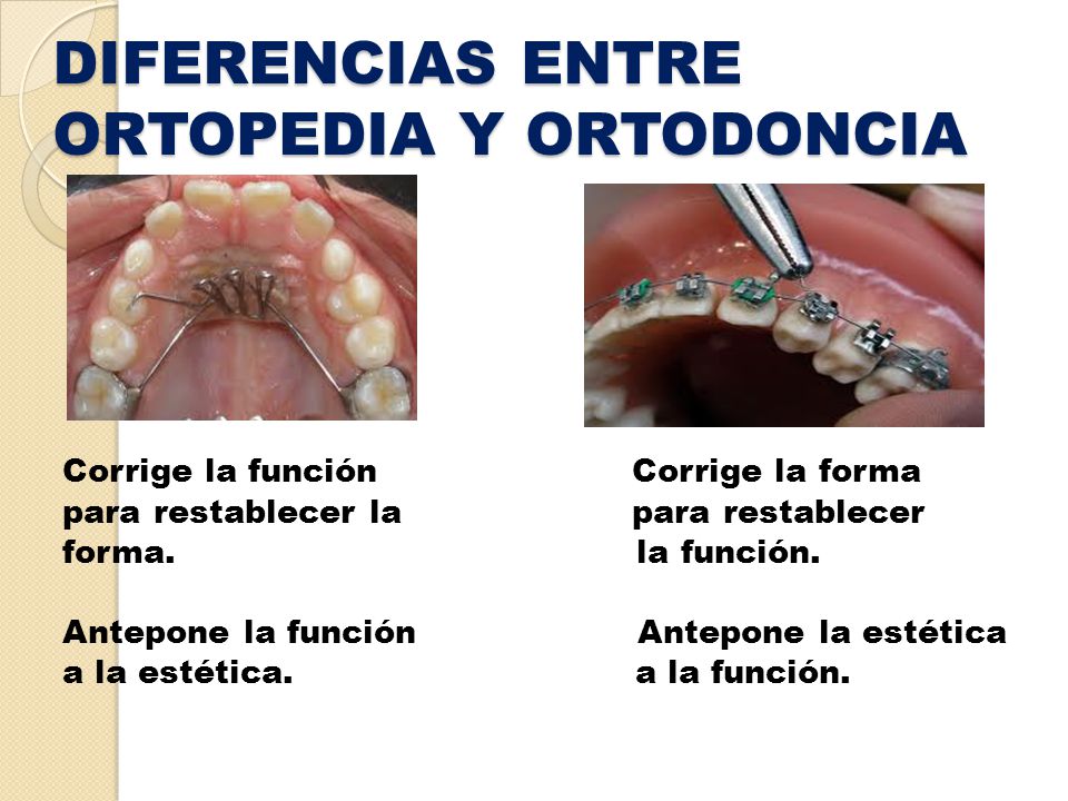 que es ortodoncia y ortopedia